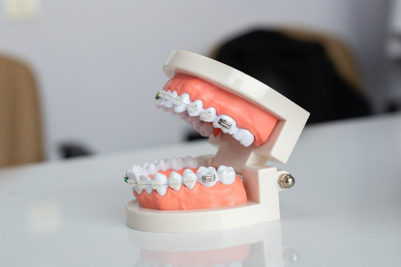 Wady zgryzu, które wymagają leczenia ortodontycznego