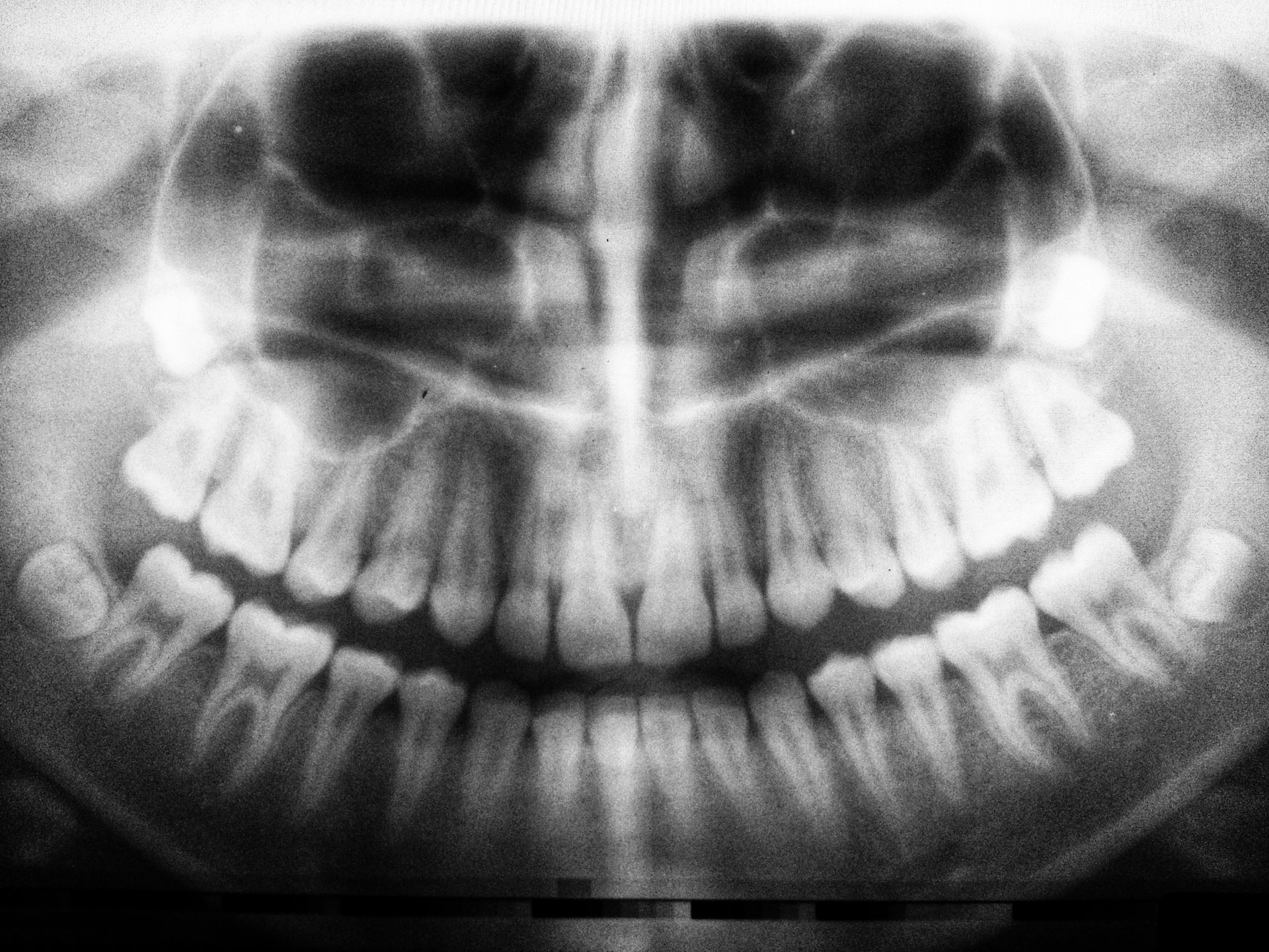 Tomografia zębów – kiedy warto ją wykonać?